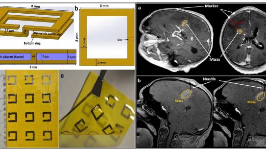 Ultra-Thin, Flexible, Passive RF Resonator Marker for MRI