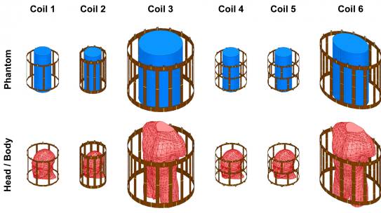 UMRAM’dan Yeni Bir Makale: Accelerating the co-simulation method for the design of transmit array coils for MRI