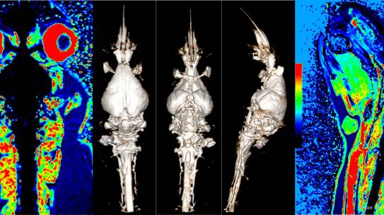 New studies by Dr. Algin and his team on Diffusion Tensor Imaging and MR Cisternography have been published in SCI journals.