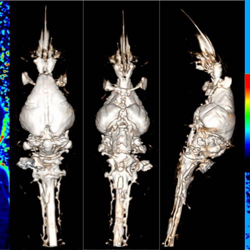 New studies by Dr. Algin and his team on Diffusion Tensor Imaging and MR Cisternography have been published in SCI journals.