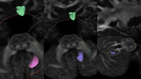 Dr. Oktay Algın and his collaborators from various institutions have had their study, “The Anatomical Connections of Nucleus Accumbens with Brainstem and Cerebellum in the Rat and Human Subjects,” published in the internationally respected journal Cerebellum.