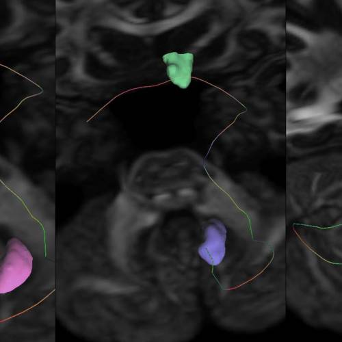 Dr. Oktay Algın ve değişik kurumlardan birlikte çalıştıkları araştırmacıların ‘Sıçan ve İnsanlarda Nükleus Akumbens’in Beyin Sapı ve Beyincik ile Anatomik Bağlantıları’ adlı çalışması Cerebellum adlı uluslararası saygın dergide yayımlandı.